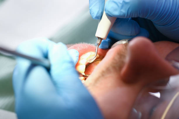 Best Emergency Broken Tooth Repair in New Brunswick, NJ